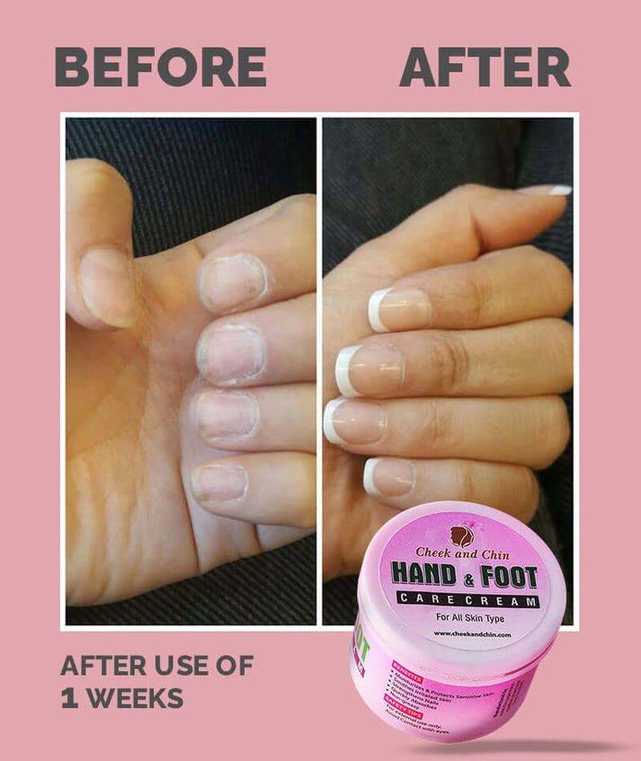 Hand and Foot whitening cream